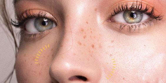 come eliminare i punti neri